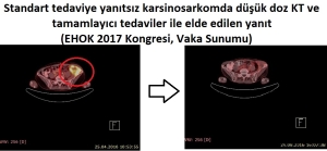Kanser Tedavisinde Bütüncül Tedavi: İmmunoonkotermi