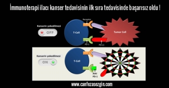 İmmunoterapi ilacı kanser tedavisinin ilk sıra tedavisinde başarısız oldu