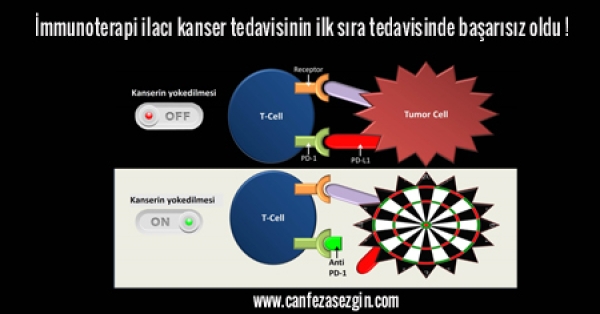 İmmunoterapi ilacı kanser tedavisinin ilk sıra tedavisinde başarısız oldu